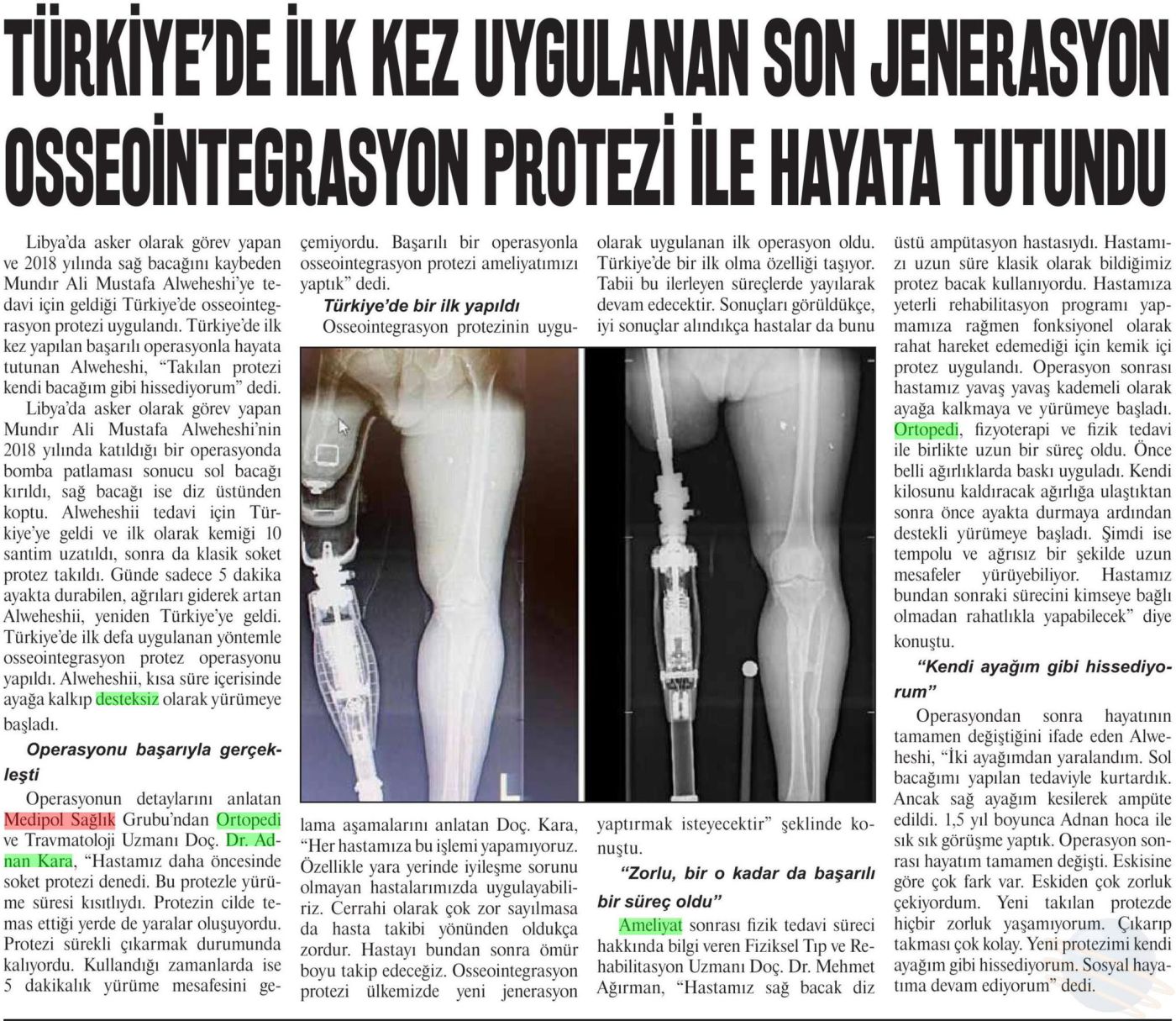 Türkiye’de ilk kez uygulanan son jenerasyon osseointegrasyon protezi ile hayata tutundu